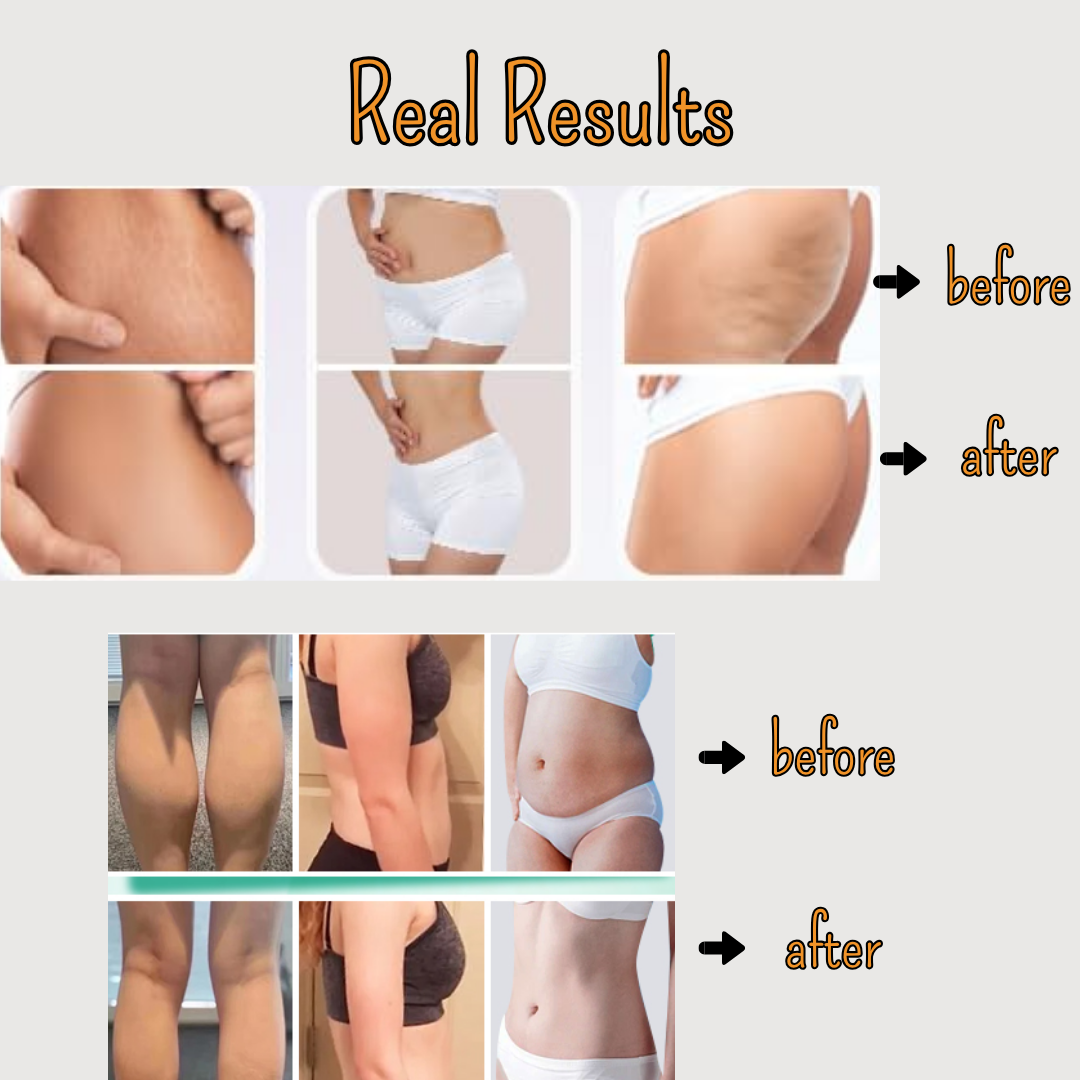 Smart Cupping Massager for Deep Tissue, Stress & Pain Relief