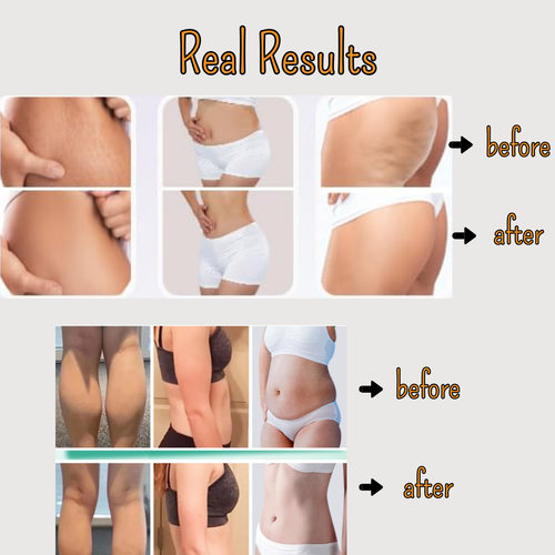 Smart Cupping Massager for Deep Tissue, Stress & Pain Relief
